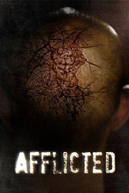 ดูหนังออนไลน์ฟรี Afflicted (2013) มหาภัยเชื้อเหนือมนุษย์